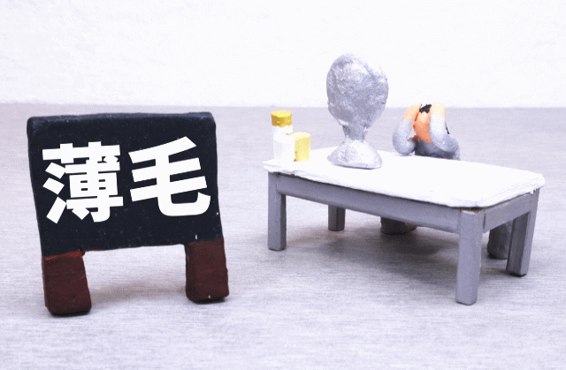 男性が薄毛（AGA）になるメカニズム！仕組みを知って対策を打つ